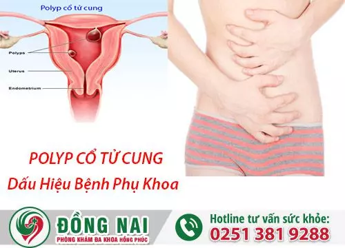 Những Triệu Chứng Các Bệnh Phụ Khoa Thường Thấy