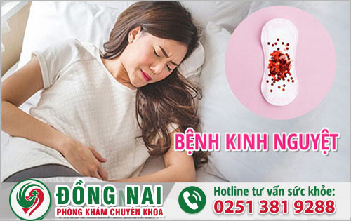 Bệnh kinh nguyệt là bệnh gì?