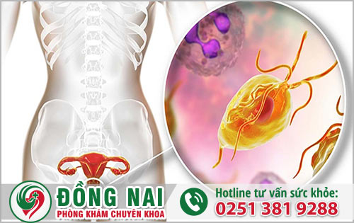 Bệnh viêm âm đạo là như thế nào và  cách chữa trị