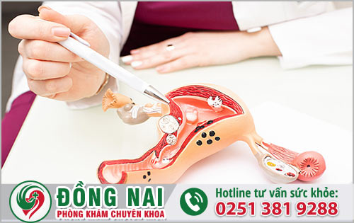 Cách giảm đau chướng bụng trong ngày hành kinh