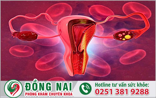 Những thông tin cần thiết về polyp cổ tử cung