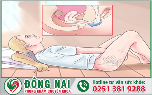 Đặt thuốc âm đạo có cảm giác đau rát nguy hiểm không?