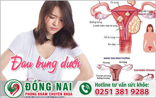 Đau bụng dưới ở nữ là dấu hiệu của những căn bệnh nào?