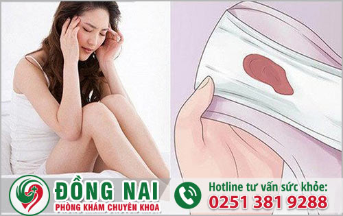 Giữa chu kỳ kinh nguyệt ra khí hư màu nâu có sao không?