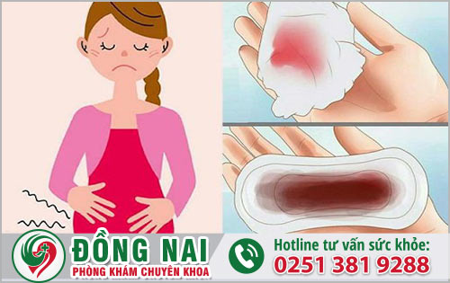 Triệu chứng của rối loạn kinh nguyệt sai sinh