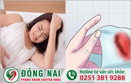 Những biểu hiện khi phá thai bằng thuốc