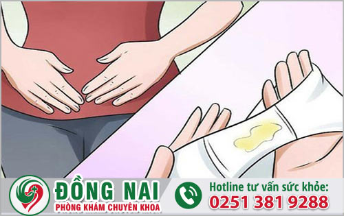 Nữ giới không nên chủ quan khi ra dịch vón cục