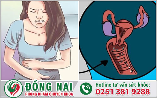 Nữ giới mắc nấm phụ khoa có nguy hiểm không?