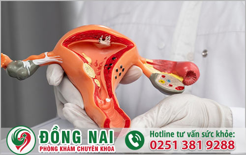 Phương pháp điều trị và phòng tránh viêm âm đạo do trùng roi