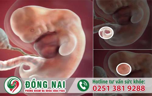 Tuổi thai nào áp dụng phương pháp phá thai bằng thuốc?