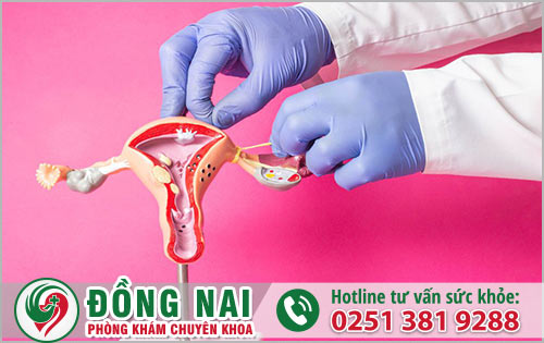 Phân loại tử cung dị dạng thường gặp ở nữ giới